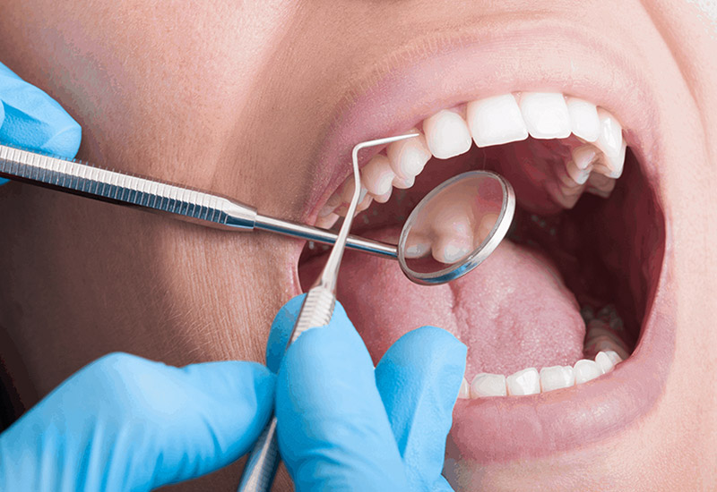 periodontal surgeries in naples