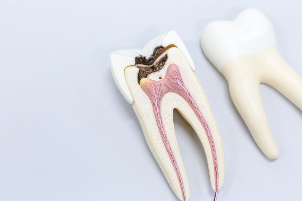 How Endodontics Can Save Your Natural Teeth