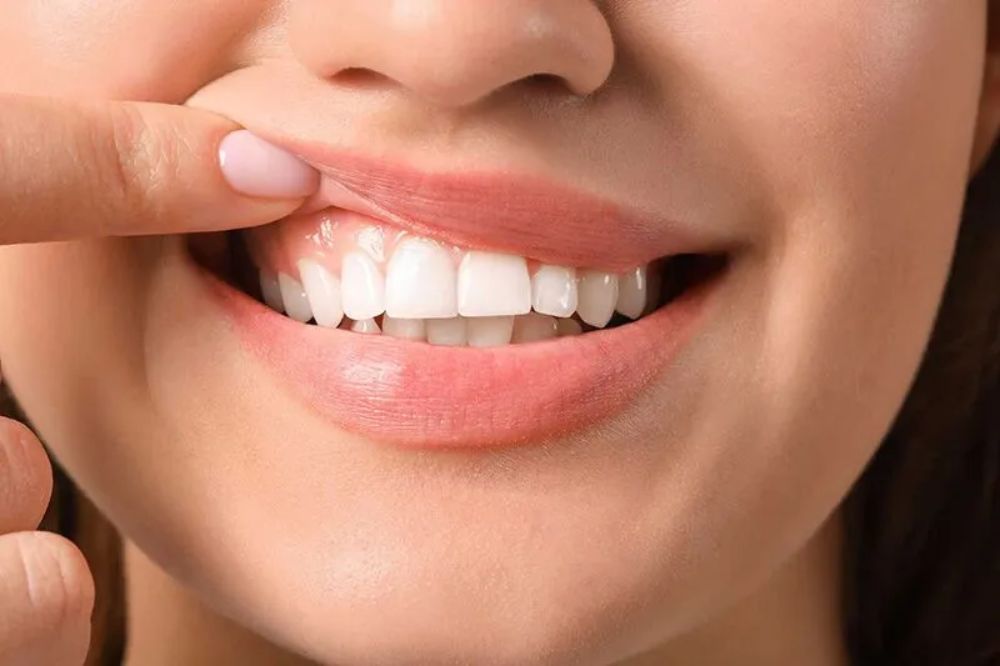 Gum Grafting for Sensitivity: Does It Really Reduce Tooth Pain?