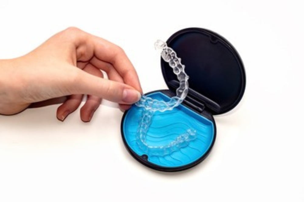 Invisalign Explained: How Clear Aligners Straighten Teeth