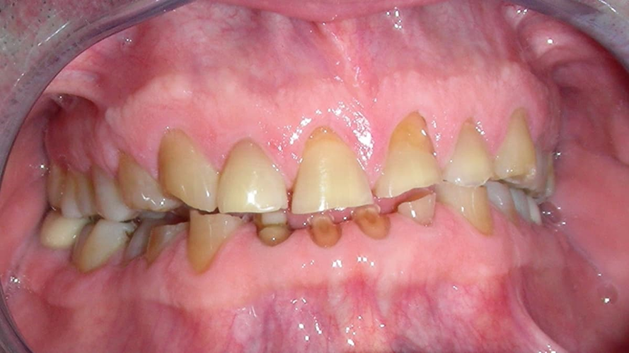 Before image